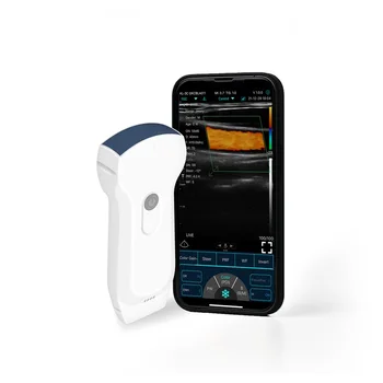 Ультразвук Wifi, медицинский портативный USB-линейный ультразвуковой зонд, портативный ручной ультразвуковой сканер